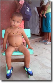 Scabies